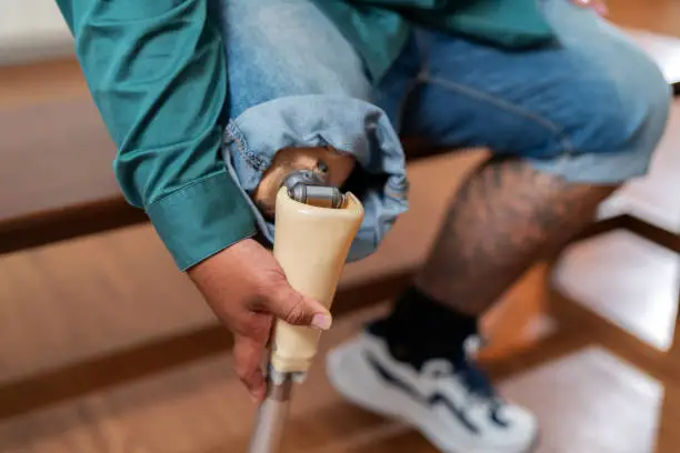 Photo of Close-up man hands adjust prosthetic leg in the comforting surroundings of kitchen. Sitting on a chair, remarkable confidence, good posture, and a sense of self-assuredness. Fine-tunes his artificial limb, demonstrating his commitment.