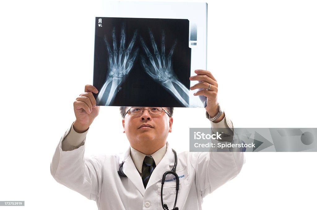 Asian Doctor Asian Doctor in white lab coat looking at x-ray of hands. 30-39 Years Stock Photo