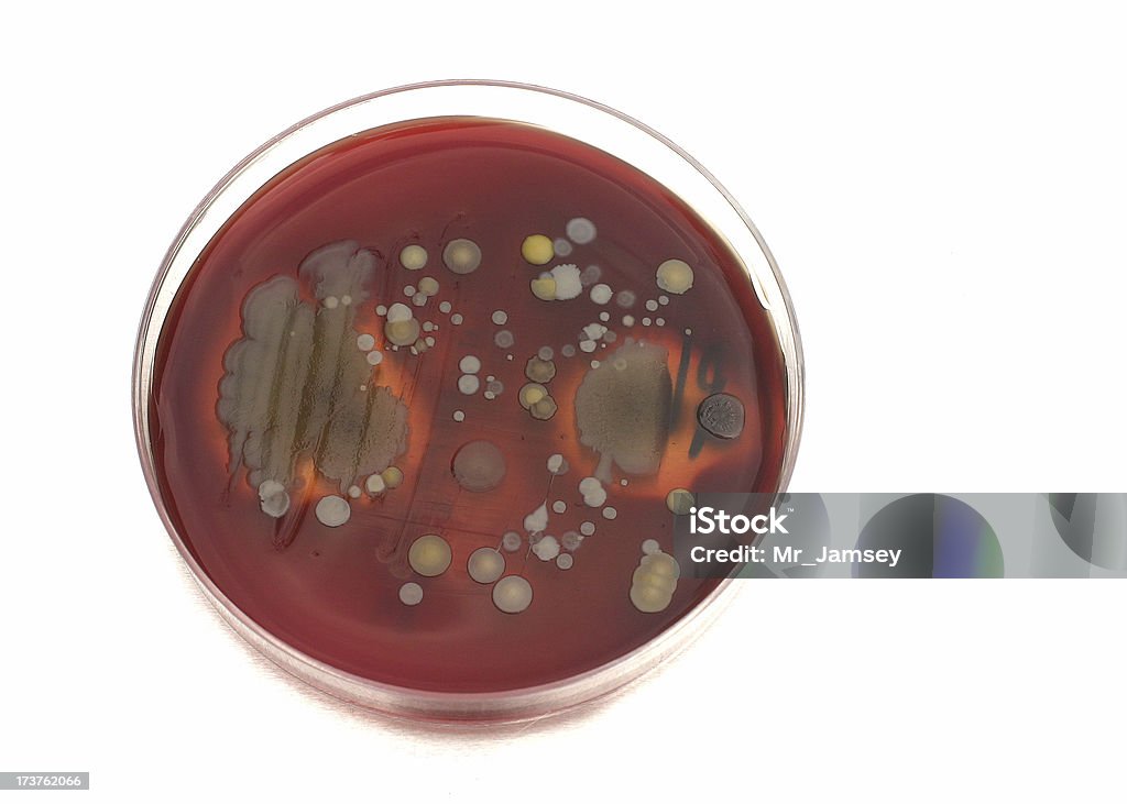 Placa de Petri con bacterias - Foto de stock de Antibiótico libre de derechos