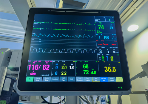 hospital monitor displaying vital signs: heart rate, blood pressure, temperature, and pulse oximetry, highlighting advanced medical technology in patient care