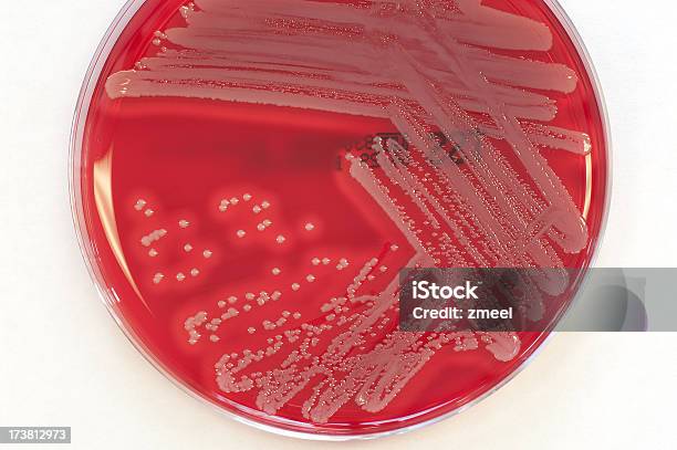Культура Золотистый Стафилококк — стоковые фотографии и другие картинки Бактерия - Бактерия, Без людей, Горизонтальный