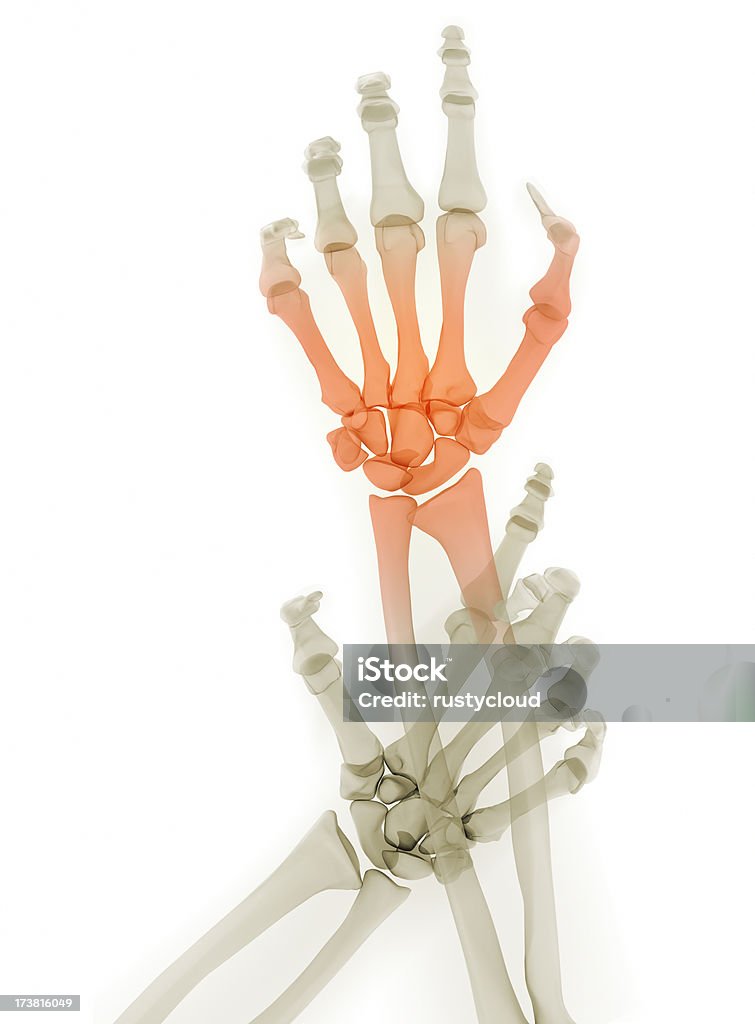 Болезненные руки - Стоковые фото Анатомия роялти-фри