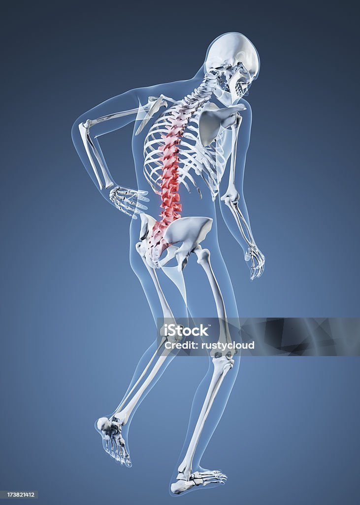 Dor nas costas de ilustração - Foto de stock de Anatomia royalty-free
