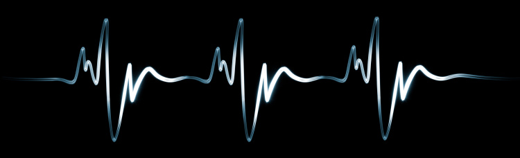 Sign of electrocardiogram (XXXL) written with flashlight on black background.