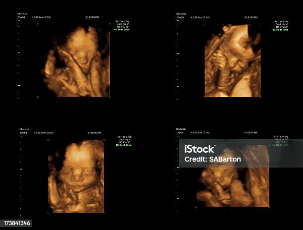 아기 3d 초음파 3차원 형태에 대한 스톡 사진 및 기타 이미지 - 3차원 형태, 초음파, 3차원 초음파