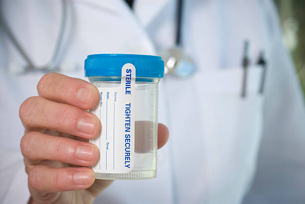 Medical personnel hand holding a Urine sample bottle stock photo