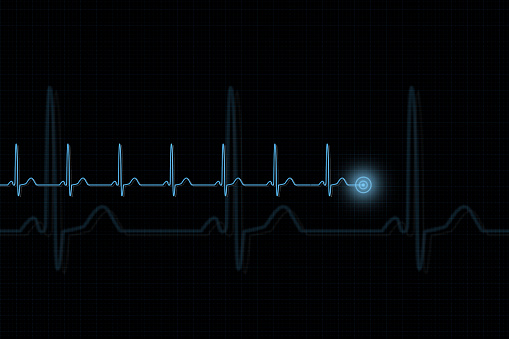 Illustration of an electrocardiogram