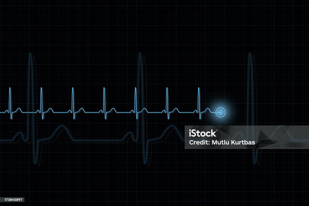 Pulse Trace Illustration of an electrocardiogram Electrocardiography Stock Photo