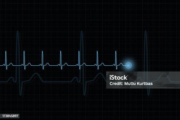 Pulse Trace Stock Photo - Download Image Now - Electrocardiography, In A Row, Listening to Heartbeat