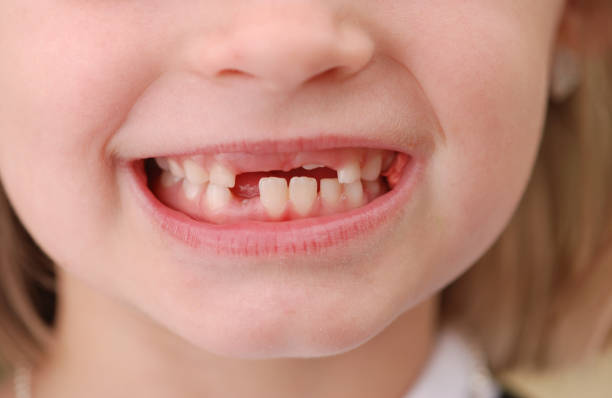 istock Close up of unrecognizable child smiling 173863340