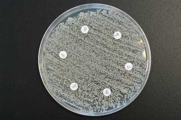 мульти резистентных бактерия - esbl стоковые фото и изображения
