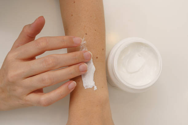 istock Topical Therapy: Applying White Cream to the Forearm 1738738995