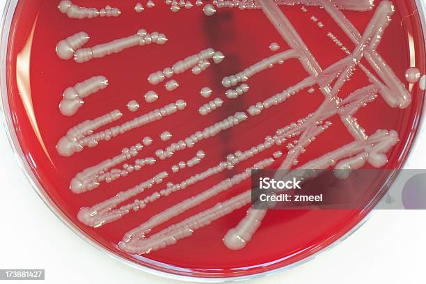 박테리아 문화 0명에 대한 스톡 사진 및 기타 이미지 - 0명, 건강관리와 의술, 과학
