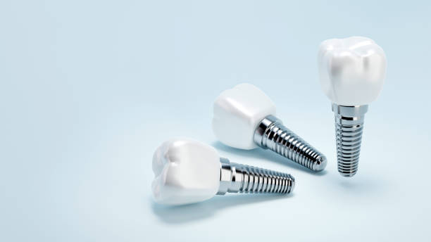 istock 3D rendering of tooth implants with ceramic crowns on color background, Modern dental surgery concept 1738985059