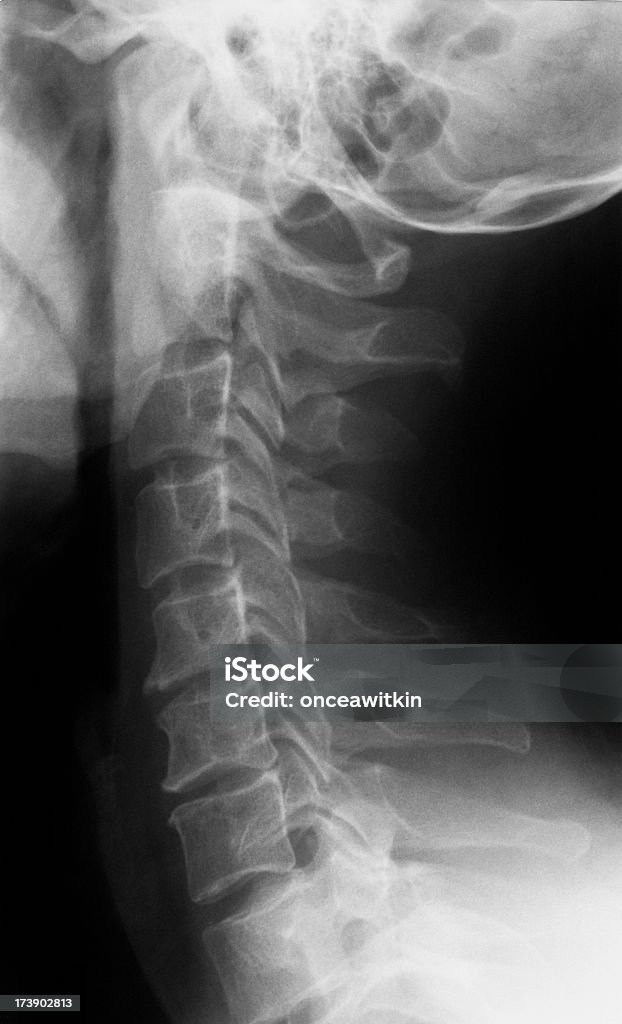 네클 X-선 - 로열티 프리 X-레이 스톡 사진