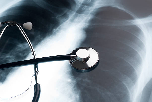 stethoscope and chest xray - ribbenkast-fotos stockfoto's en -beelden