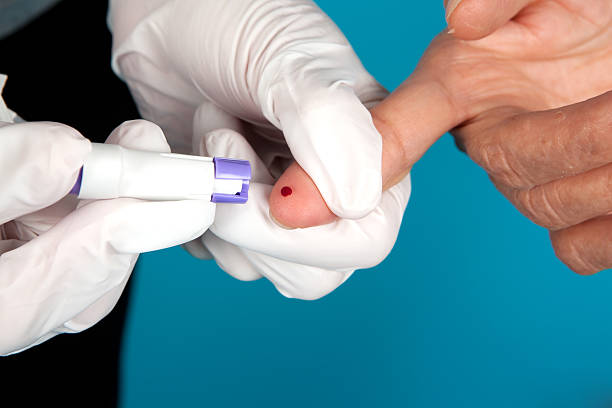 Drop of blood on a man's finger from getting it pricked Nurse pricking a patient's finger. Please view all pictures from this series along with other medical shots in my portfolio. scalpel stock pictures, royalty-free photos & images