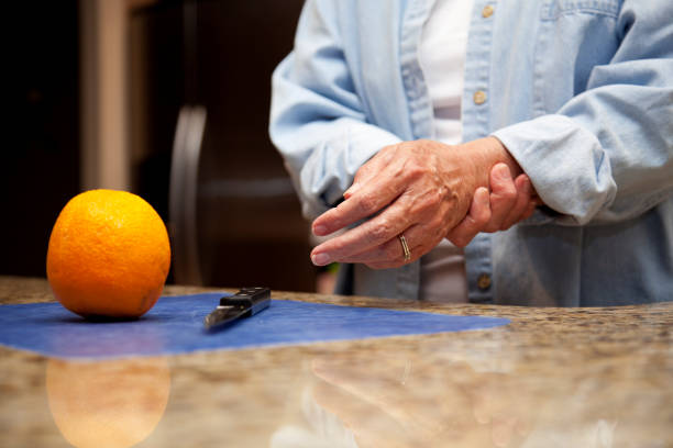 arthritis pain in hands stock photo