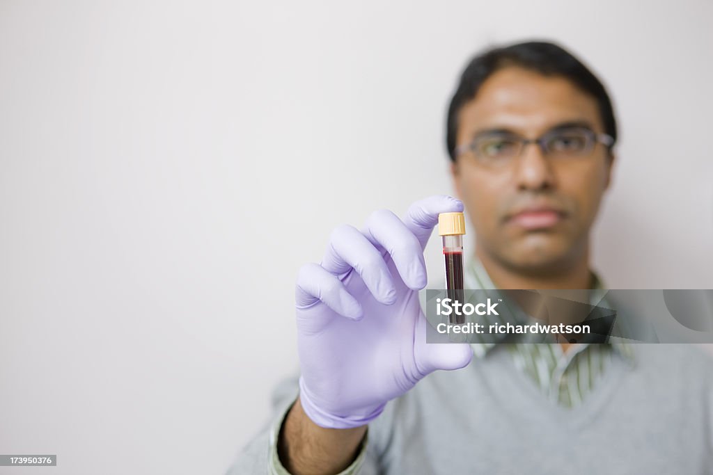 Próbki krwi - Zbiór zdjęć royalty-free (Badanie krwi - Test medyczny)