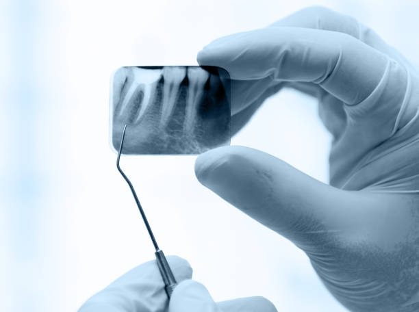 istock Tooth x-ray being examined by a dentist 1740122811