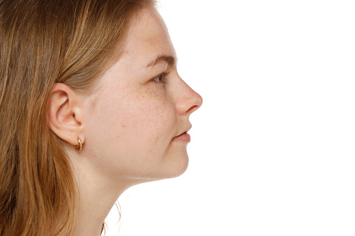 Closeup profile of a young woman's face, mouth, nose and cheek on a white studio background