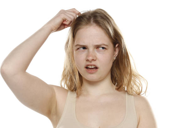 istock Confused Young Woman Scratching Head On White Background 1740256930