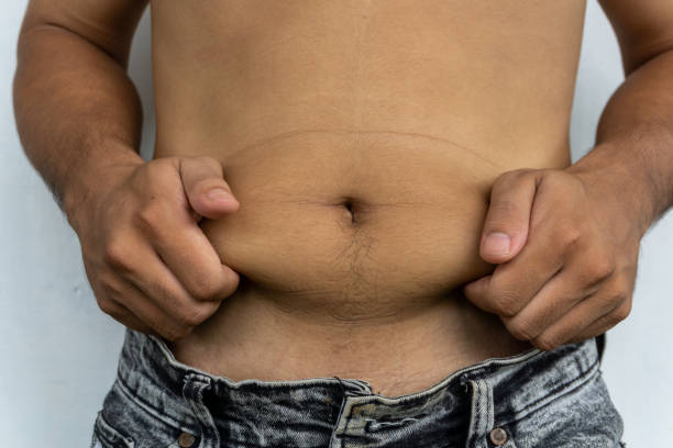 istock front view om man fat belly. Man holding his fat belly 1740436842