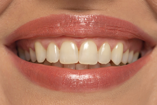 Close-up of a woman's mouth, capturing a confident smile and perfect natural teeth and lips