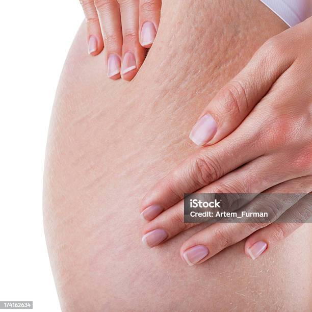 Stretch Marks And Cellulite Stock Photo - Download Image Now - Stretch Mark, One Woman Only, Women