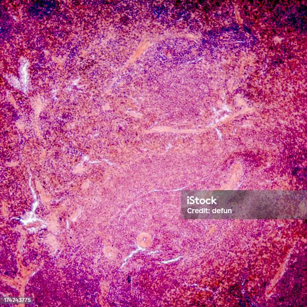 Bauchspeicheldrüse Stockfoto und mehr Bilder von Gewebe - Gewebe, Enzym, Bauch