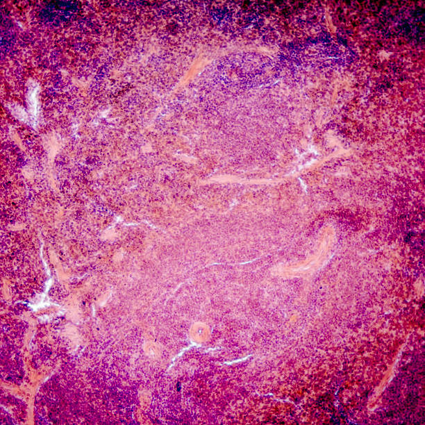 pâncreas - célula alfa - fotografias e filmes do acervo