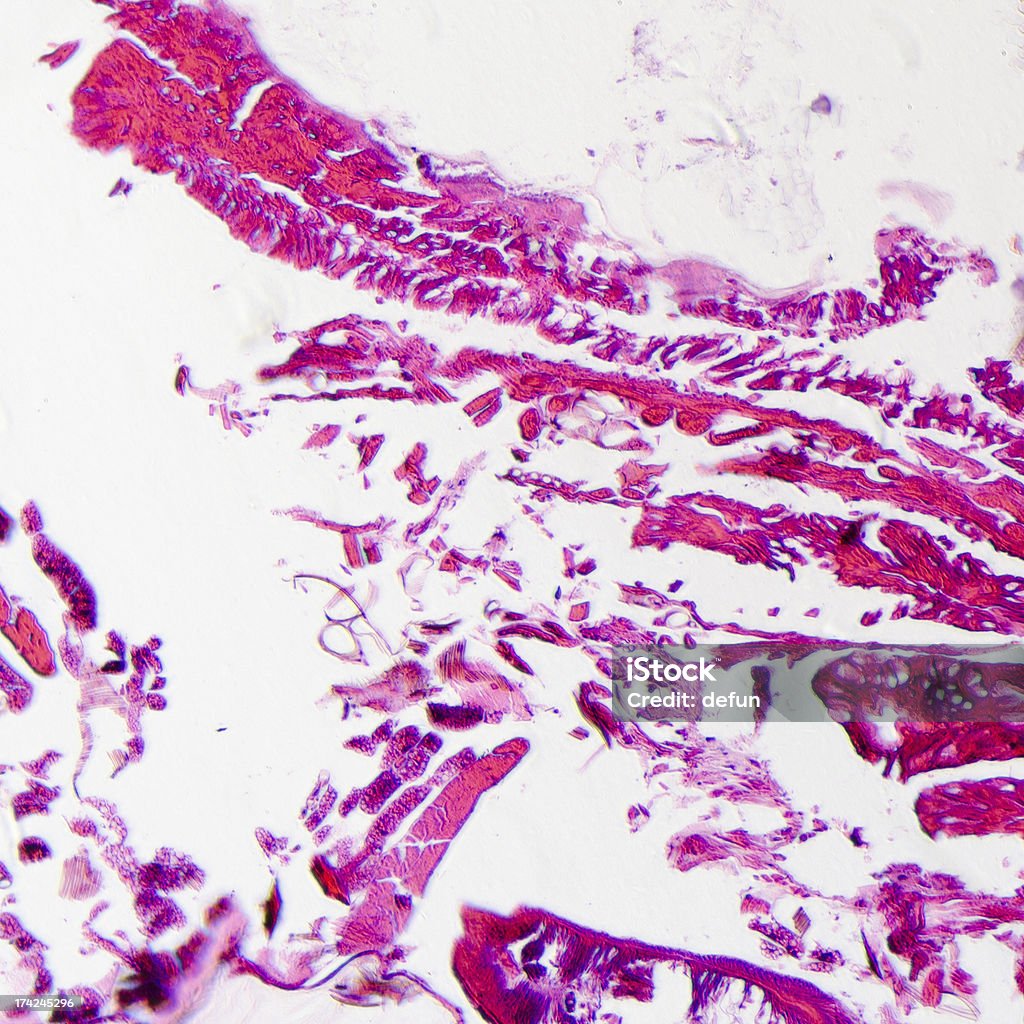 Micrografia de insetos corpo seção transversal, Lagarta de Mariposa - Foto de stock de Alta Magnificação royalty-free