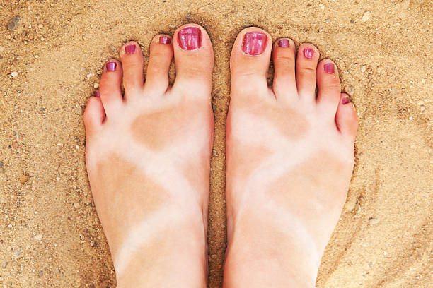 istock Funny tanned legs 174272260