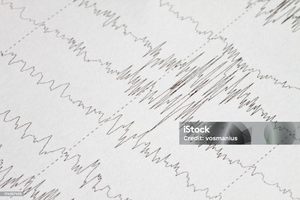 Elektro-encephalogramme - Lizenzfrei EEG Stock-Foto