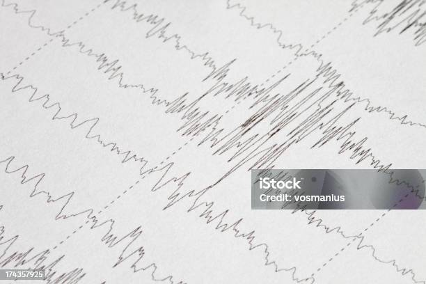 Elektroencephalogramme Stockfoto und mehr Bilder von EEG - EEG, Pulslinie, Tot