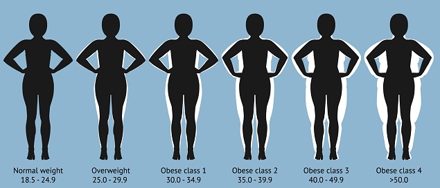 Female figures with normal weight, overweight and obesity. Vector illustration