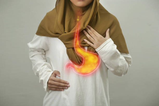 istock Digital composition of internal digestive system with stomach acid flows back to esophagus on person with GERD disease, woman with suffer from heartburn pain in her chest, health and medical 1745354685