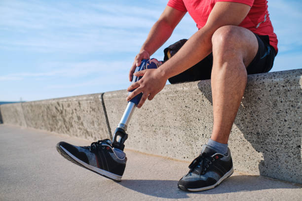 istock Unrecognizable young man with one leg adjusting his prosthetic leg sitting on a retaining wall near the beach 1746069135