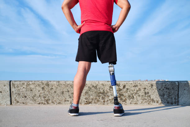 istock Unrecognizable man with artificial leg standing in front of the beach with hands on hips 1746069177