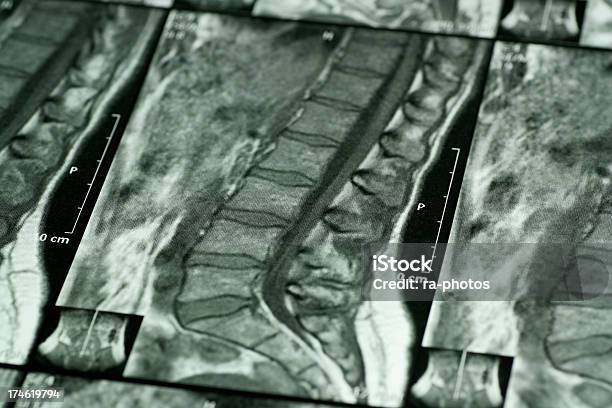 Photo libre de droit de Tomography Scanner banque d'images et plus d'images libres de droit de Anatomie - Anatomie, Beauté, Chiropracteur