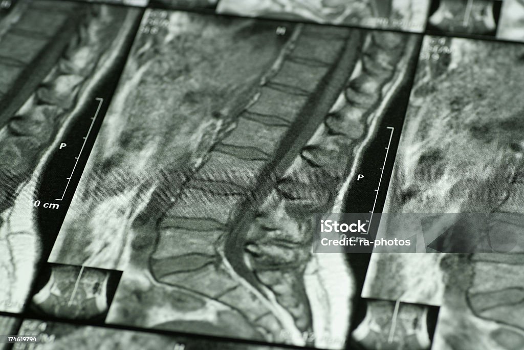 Exame de tomografia - Royalty-free Anatomia Foto de stock