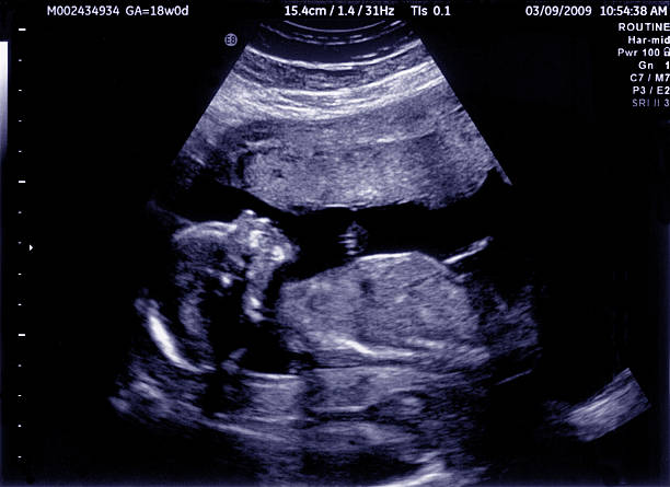 Fetal Ultrasound Image stock photo