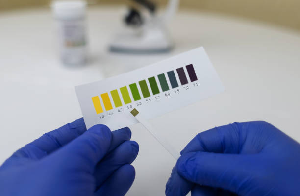istock Bacterial Vaginosis. Vaginal pH. Diagnostic. Scale by which you can measure whether acidity normal or not. Normal acidity level shown in colors and must be compared with standard. Laboratory and home 1746311142
