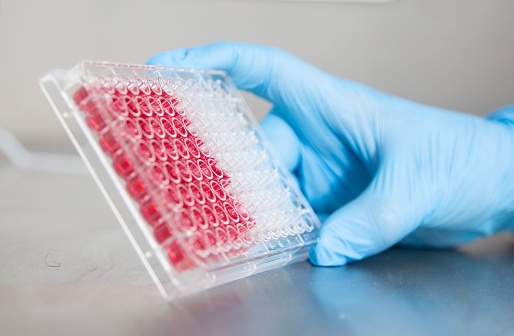 The expert holding a small tray filled with red sample for experiments