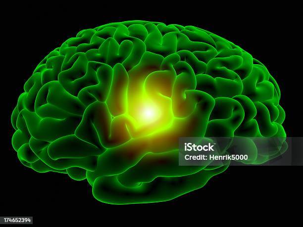 Rtg Mózgu - zdjęcia stockowe i więcej obrazów Mózg - Mózg, Zielony kolor, Badania