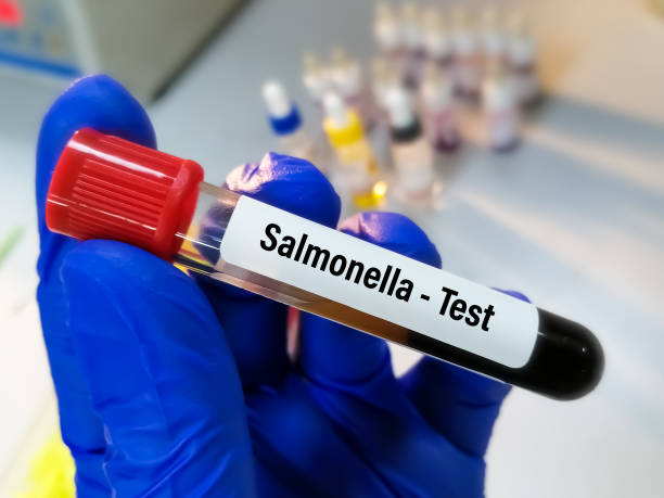 istock Blood sample for Salmonella bacteria test, Typhoid fever test 1746531474