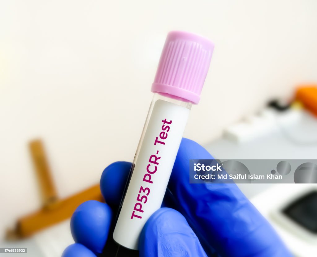 Blood Sample For Tp53 Pcr Testing Lifraumeni Syndrome Stock Blood Sample For Tp53 Pcr Testing Lifraumeni Syndrome Stock