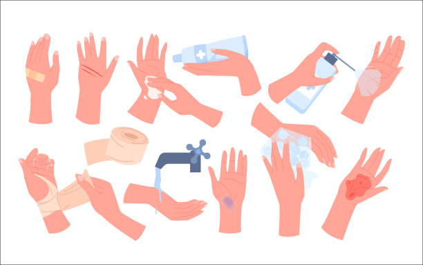 Cartoon isolated broken arms with wound, bruise or bleeding dressing with elastic bandage and band aid, hands apply ice bag and disinfectant. First aid for trauma, infographic set vector illustration. Cartoon isolated broken arms with wound, bruise or bleeding dressing with elastic bandage and band aid, hands apply ice bag and disinfectant. First aid for trauma, infographic set vector illustration bandage arm stock illustrations