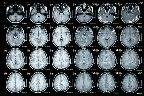 Tomografía computarizada craneal imagen de paciente niño photo
