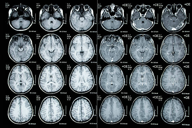 tomografía computarizada craneal imagen de paciente niño - tomografía fotografías e imágenes de stock